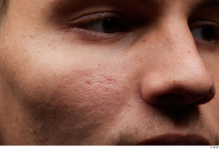 HD Face Skin darren cheek eye face nose skin pores…